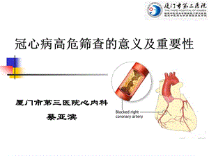 蔡亚滨--冠心病的诊断流程和选择PPT.pptx